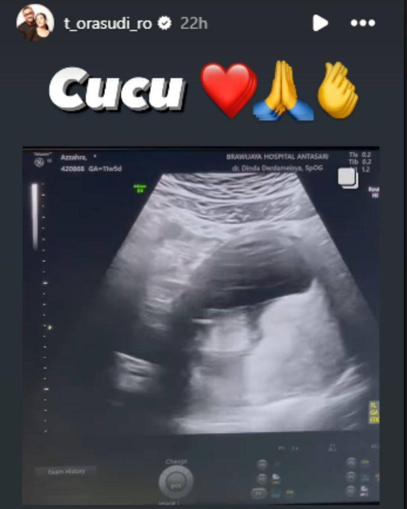 Instagram.com/t_orasudi_ro